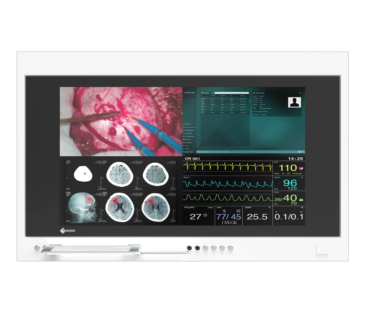 EIZO CuratOR SP1-554K, photo du modèle exact.