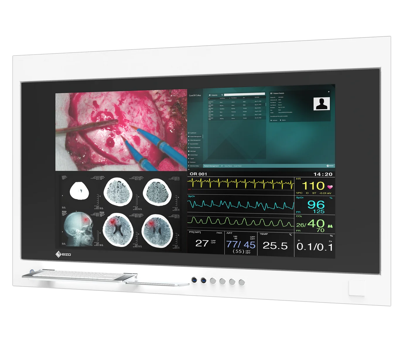 EIZO CuratOR SP1-554K, vue de profil.